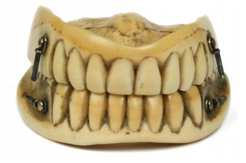 ancient denture