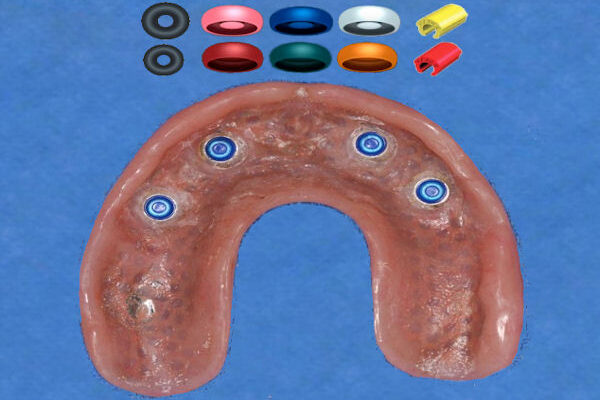 locator_oring_replacement