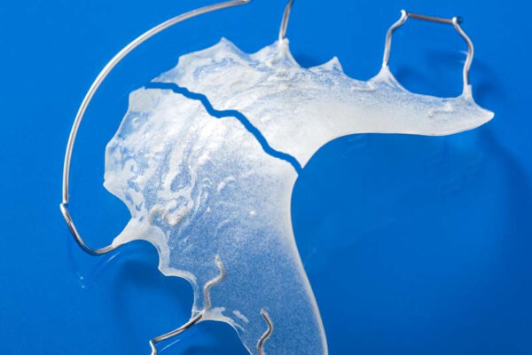 Dental Retainer Repair