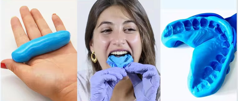 Dental Impression Convenience